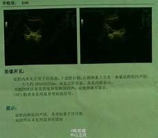 异常y物见闻录9